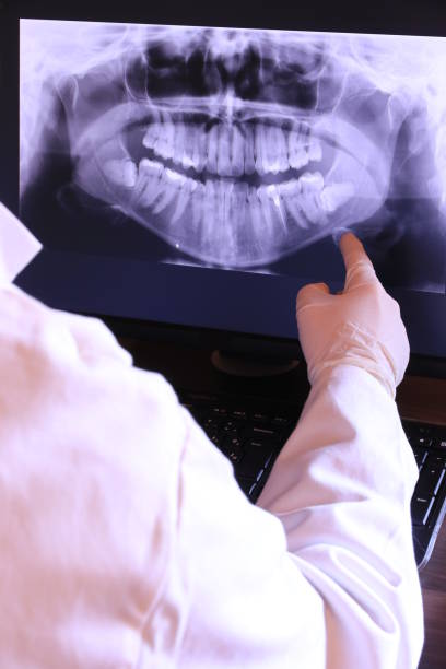 Best Emergency Tooth Extraction in Garner, NC